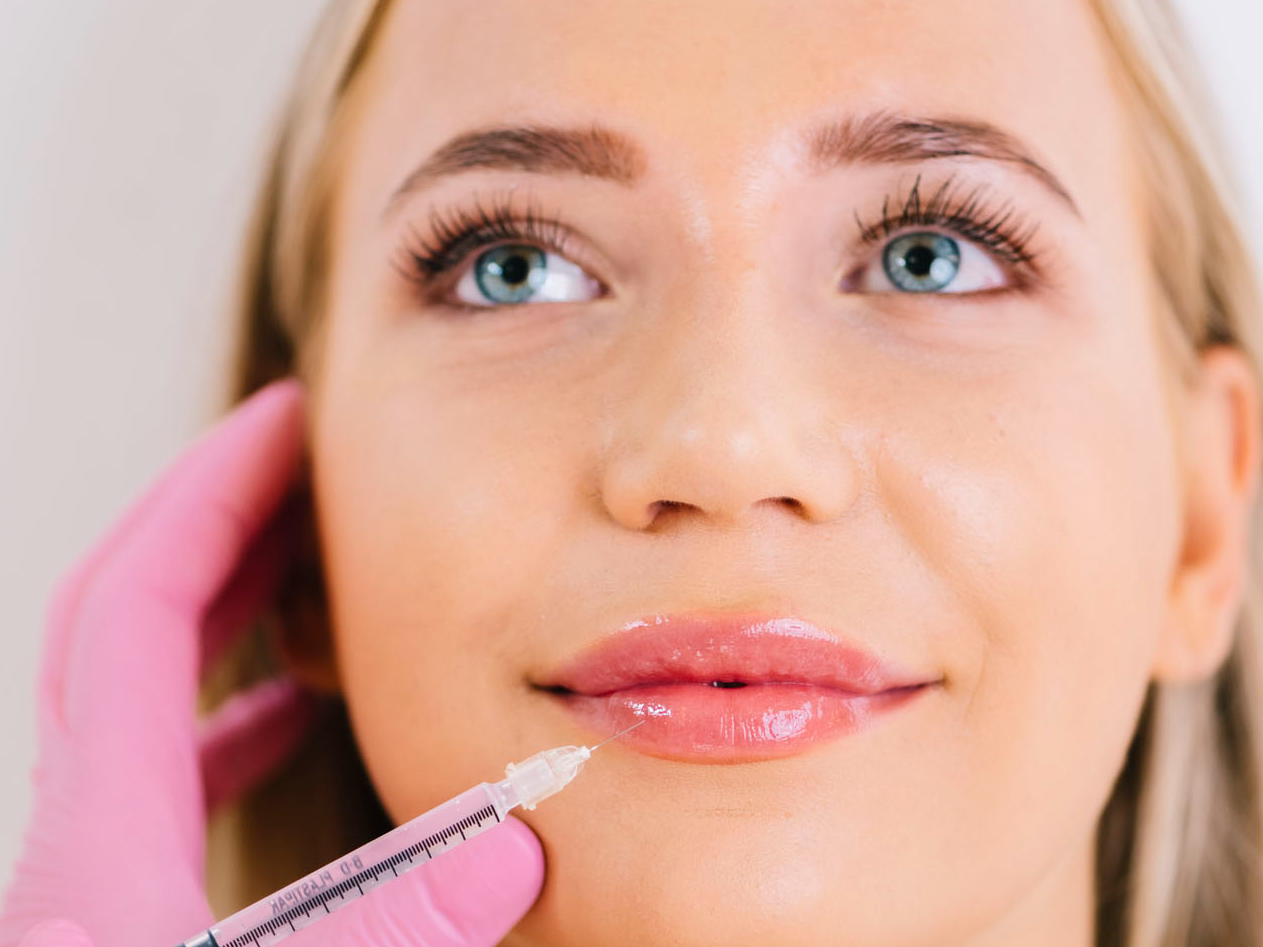 Filler behandeling voor vollere lippen