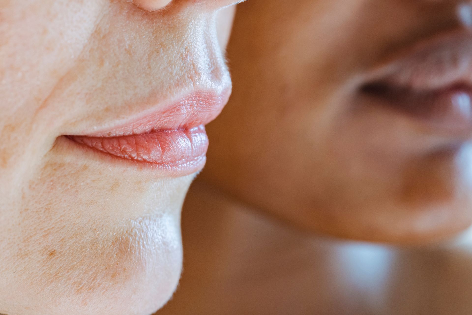 Lippen opvullen en meer volume geven